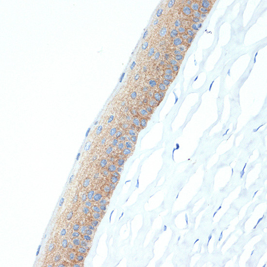 CRABP1 Antibody in Immunohistochemistry (Paraffin) (IHC (P))