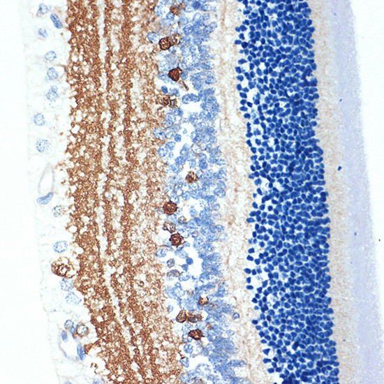 CRABP1 Antibody in Immunohistochemistry (Paraffin) (IHC (P))