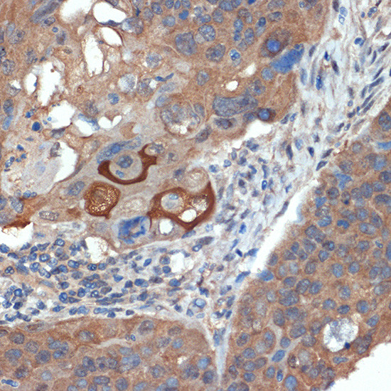 CRABP1 Antibody in Immunohistochemistry (Paraffin) (IHC (P))