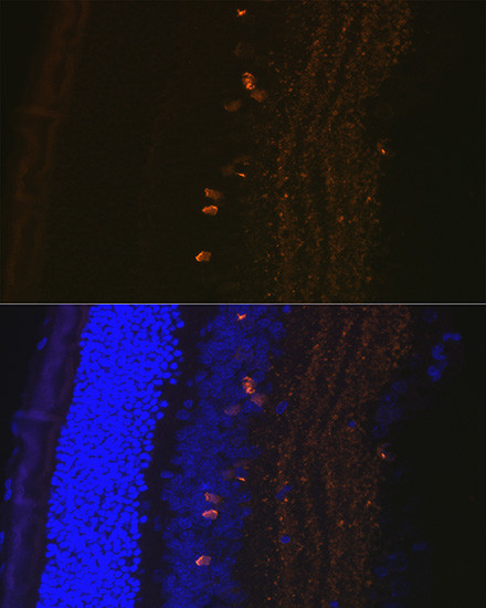 CRABP1 Antibody in Immunohistochemistry (Paraffin) (IHC (P))