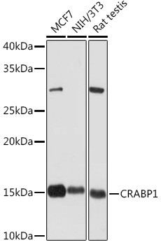 CRABP1 Antibody in Western Blot (WB)