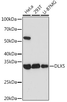 DLX5 Antibody in Western Blot (WB)