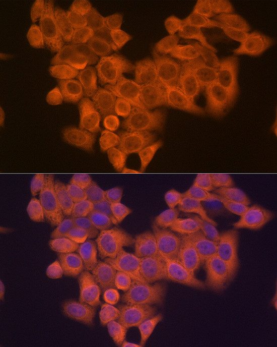 PIK3R4 Antibody in Immunocytochemistry (ICC/IF)