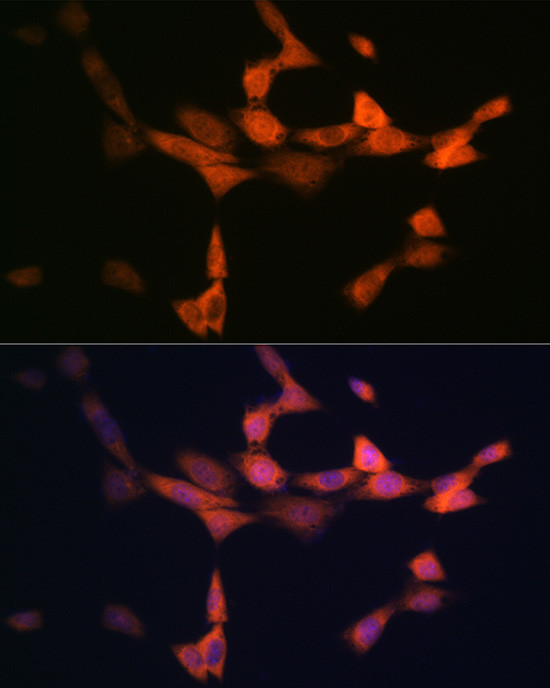 PIK3R4 Antibody in Immunocytochemistry (ICC/IF)