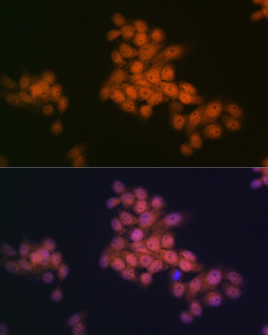 WAPL Antibody in Immunocytochemistry (ICC/IF)