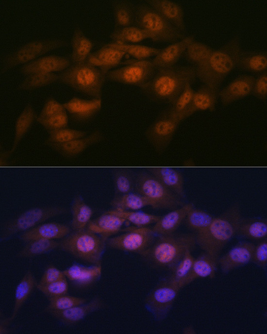 WAPL Antibody in Immunocytochemistry (ICC/IF)