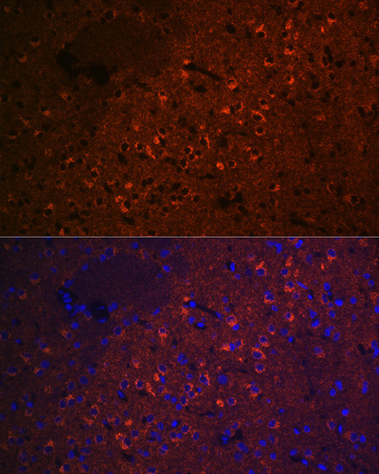 CEND Antibody in Immunocytochemistry (ICC/IF)