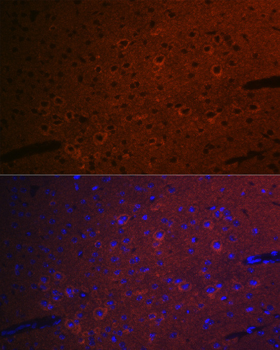 CEND Antibody in Immunocytochemistry (ICC/IF)