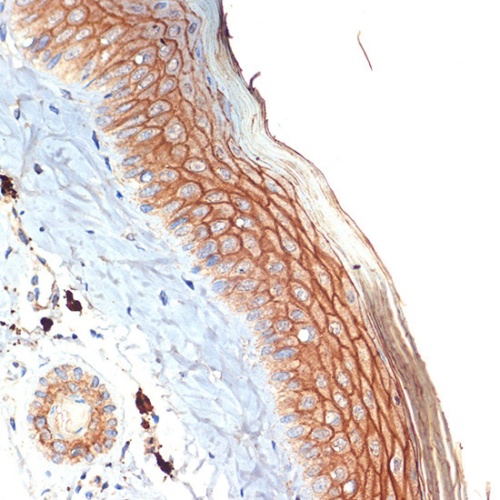 PERP Antibody in Immunohistochemistry (Paraffin) (IHC (P))