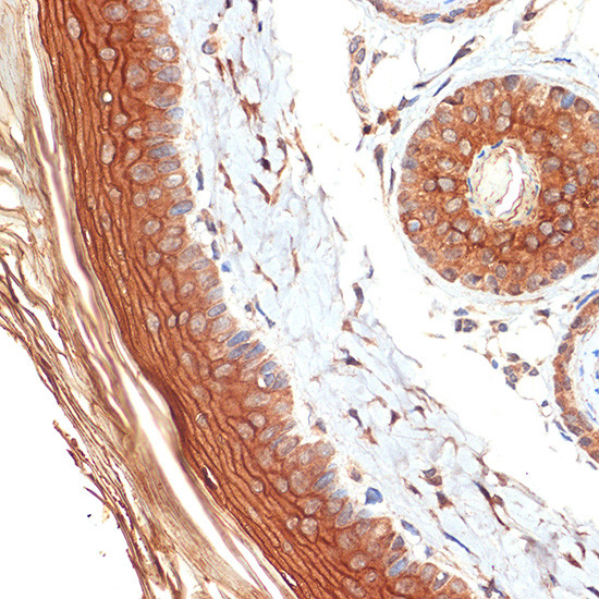 PERP Antibody in Immunohistochemistry (Paraffin) (IHC (P))