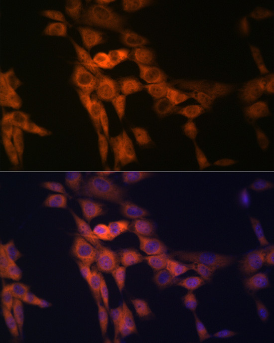 CD266 Antibody in Immunocytochemistry (ICC/IF)