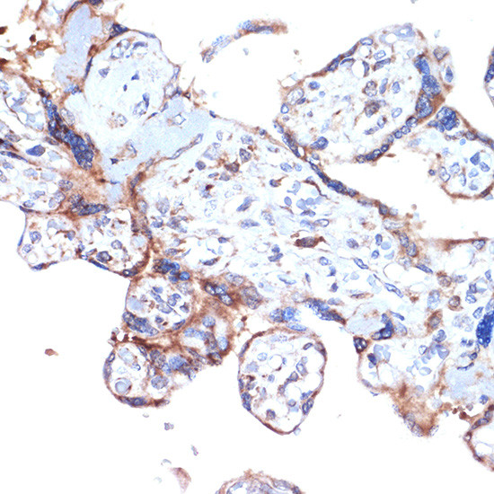 ARTS1 Antibody in Immunohistochemistry (Paraffin) (IHC (P))