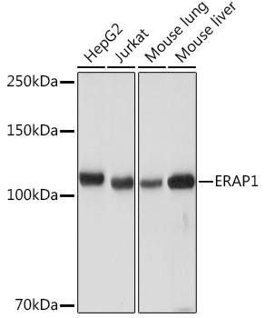 ARTS1 Antibody in Western Blot (WB)