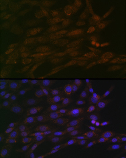 CHD3 Antibody in Immunocytochemistry (ICC/IF)