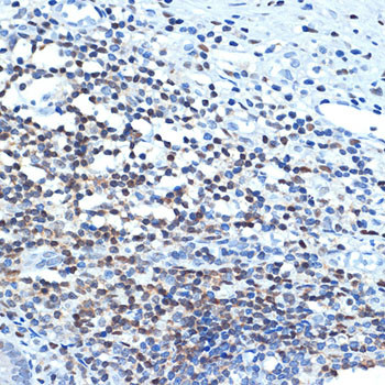 CHD3 Antibody in Immunohistochemistry (Paraffin) (IHC (P))