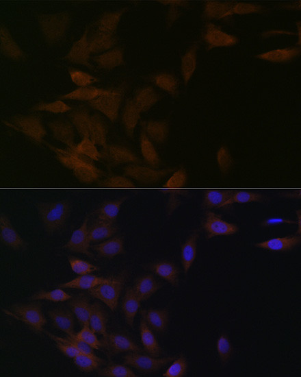 PP2A alpha/beta Antibody in Immunocytochemistry (ICC/IF)