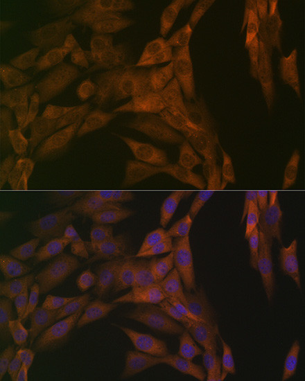 PP2A alpha/beta Antibody in Immunocytochemistry (ICC/IF)