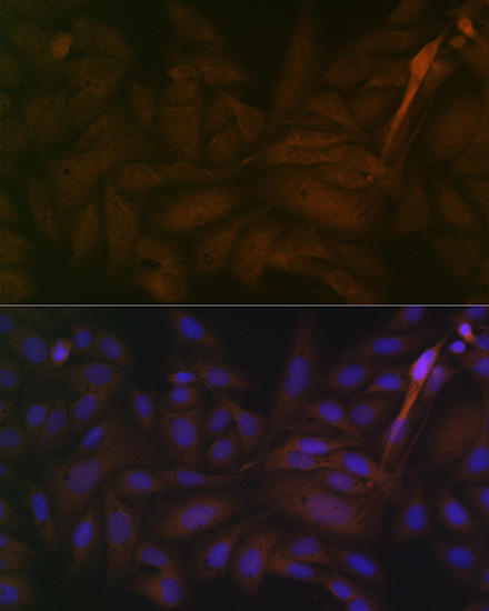 PP2A alpha/beta Antibody in Immunocytochemistry (ICC/IF)