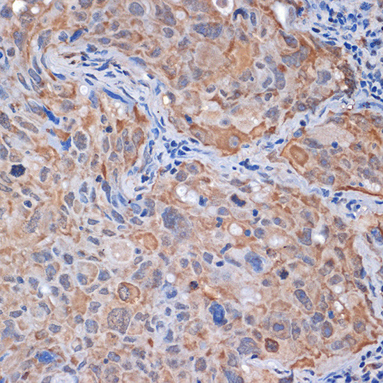 PP2A alpha/beta Antibody in Immunohistochemistry (Paraffin) (IHC (P))