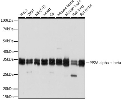 PP2A alpha/beta Antibody in Western Blot (WB)