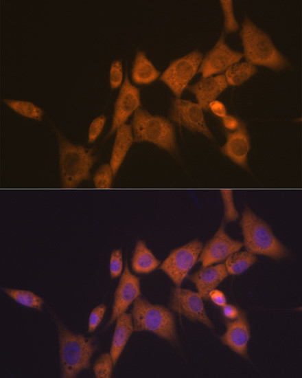 ATG10 Antibody in Immunocytochemistry (ICC/IF)