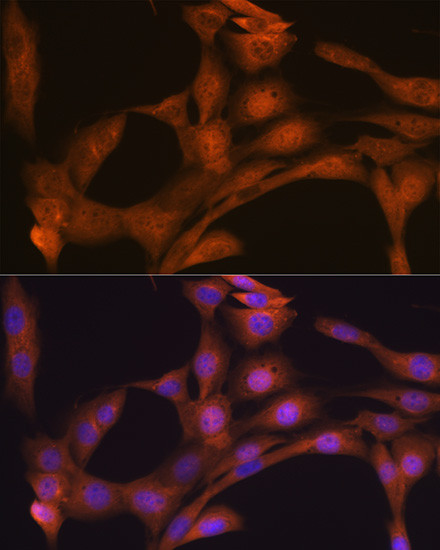 CLOCK Antibody in Immunocytochemistry (ICC/IF)