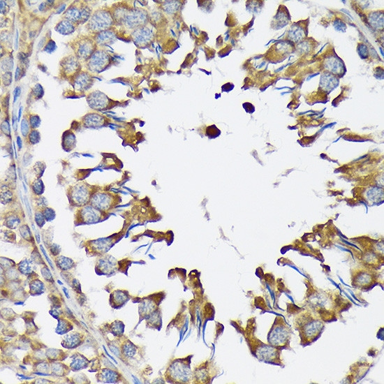 KARS Antibody in Immunohistochemistry (Paraffin) (IHC (P))