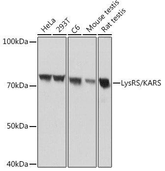 KARS Antibody in Western Blot (WB)