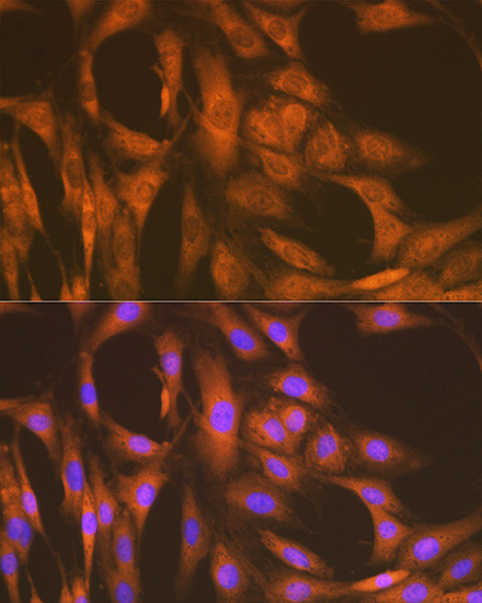 UAP1 Antibody in Immunocytochemistry (ICC/IF)