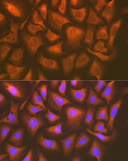 UAP1 Antibody in Immunocytochemistry (ICC/IF)