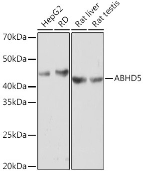 ABHD5 Antibody in Western Blot (WB)