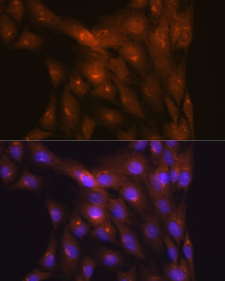 NDUFS4 Antibody in Immunocytochemistry (ICC/IF)