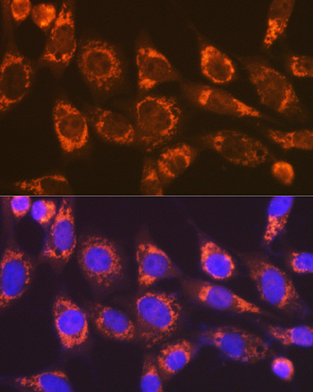 DIABLO Antibody in Immunocytochemistry (ICC/IF)