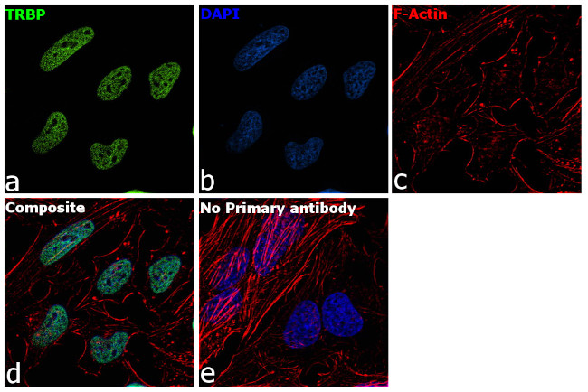 TRBP Antibody in Immunocytochemistry (ICC/IF)