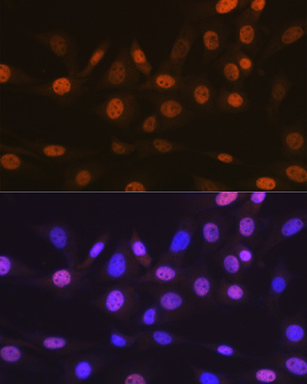 TRBP Antibody in Immunocytochemistry (ICC/IF)