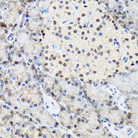 TRBP Antibody in Immunohistochemistry (Paraffin) (IHC (P))