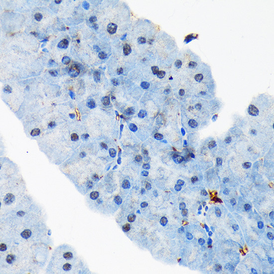 TRBP Antibody in Immunohistochemistry (Paraffin) (IHC (P))