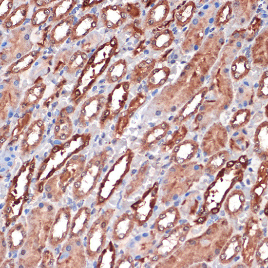 Carbonic Anhydrase II Antibody in Immunohistochemistry (Paraffin) (IHC (P))