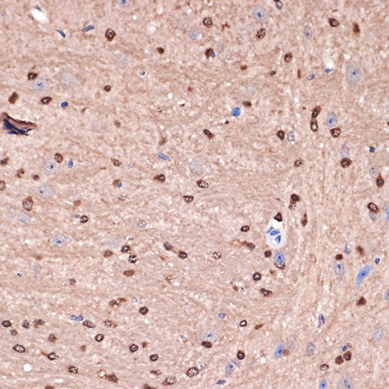 Carbonic Anhydrase II Antibody in Immunohistochemistry (Paraffin) (IHC (P))