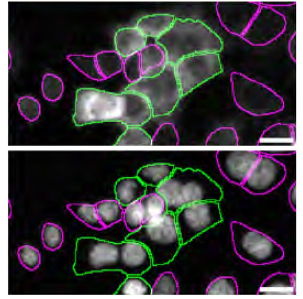 CK1 alpha Antibody in Immunocytochemistry (ICC/IF)