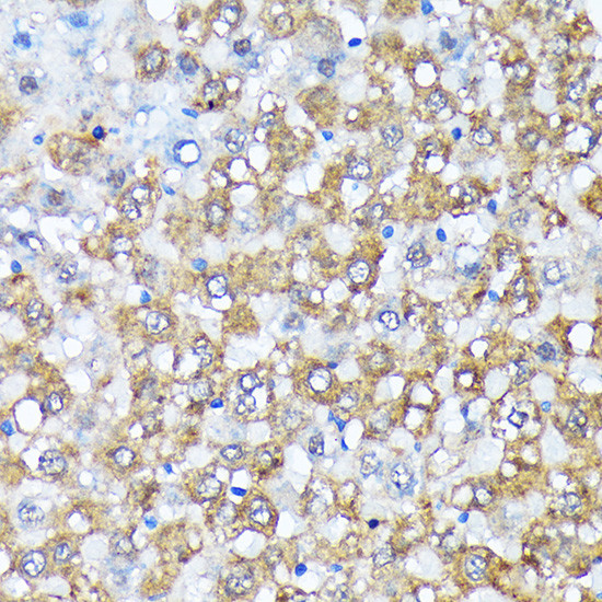 CK1 alpha Antibody in Immunohistochemistry (Paraffin) (IHC (P))