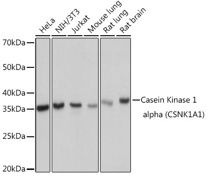 CK1 alpha Antibody in Western Blot (WB)