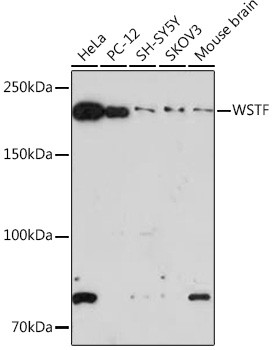 BAZ1B Antibody in Western Blot (WB)