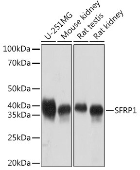 SFRP1 Antibody in Western Blot (WB)