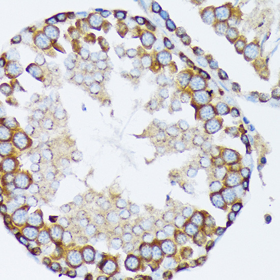 gamma Tubulin Antibody in Immunohistochemistry (Paraffin) (IHC (P))