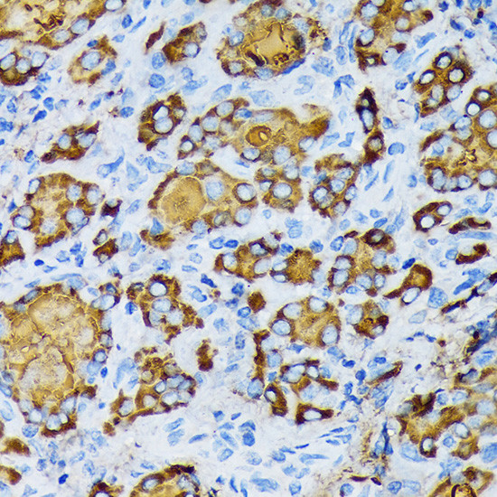 gamma Tubulin Antibody in Immunohistochemistry (Paraffin) (IHC (P))