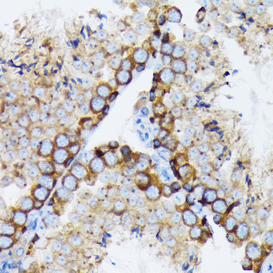 gamma Tubulin Antibody in Immunohistochemistry (Paraffin) (IHC (P))