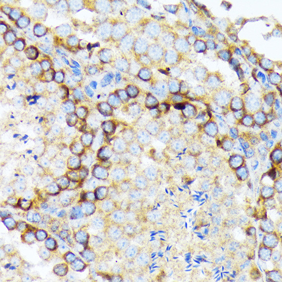 EIF2A Antibody in Immunohistochemistry (Paraffin) (IHC (P))