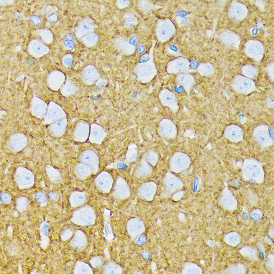 GluR6 Antibody in Immunohistochemistry (Paraffin) (IHC (P))