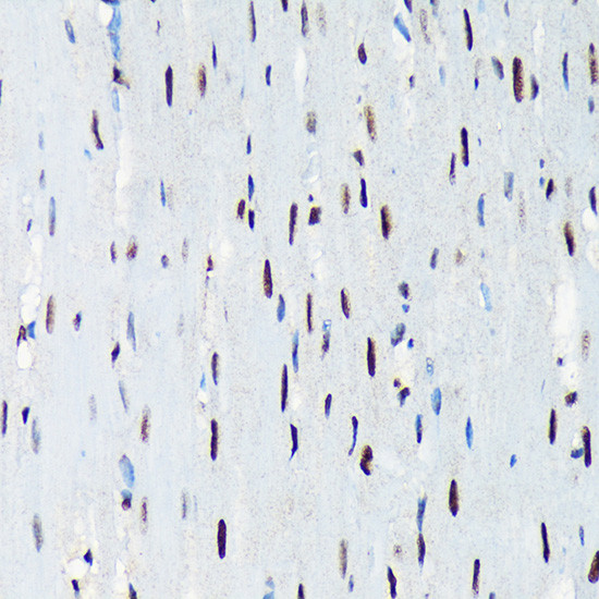 UAP56 Antibody in Immunohistochemistry (Paraffin) (IHC (P))